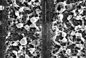 REM-Aufnahme einer mikrostabilisierten Silizium-Anode